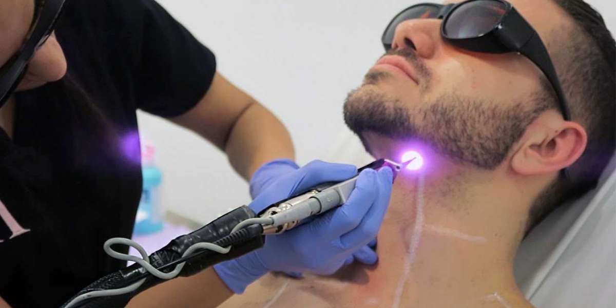 Average laser hair removal cost